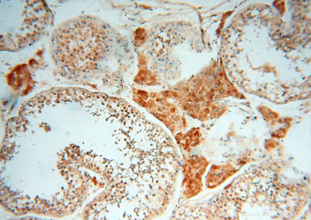 Immunohistochemistry (IHC) staining of human testis tissue using BAG1S/1M/1L Polyclonal antibody (16150-1-AP)