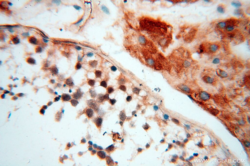 Immunohistochemistry (IHC) staining of human testis tissue using BAG1S/1M/1L Polyclonal antibody (16150-1-AP)