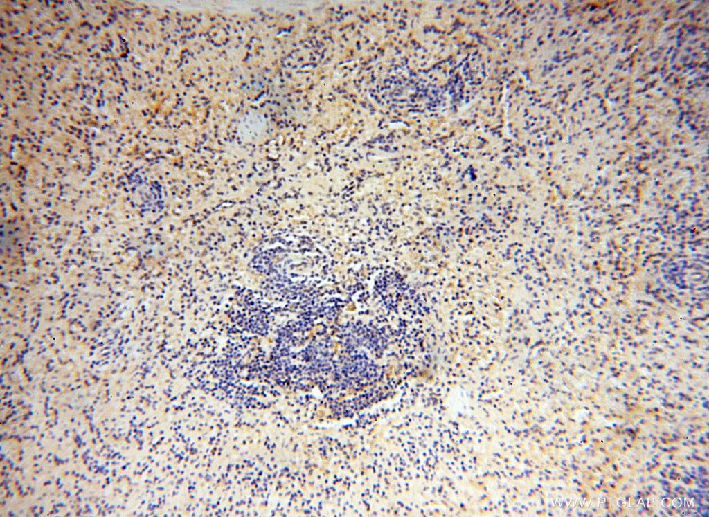 Immunohistochemistry (IHC) staining of human spleen tissue using BAG1S/1M/1L Polyclonal antibody (16150-1-AP)