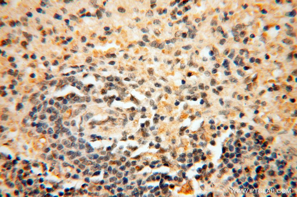 Immunohistochemistry (IHC) staining of human spleen tissue using BAG1S/1M/1L Polyclonal antibody (16150-1-AP)