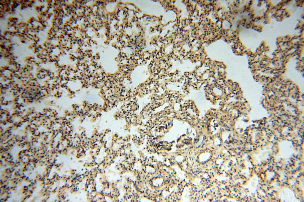 Immunohistochemistry (IHC) staining of human lung tissue using BAG1S/1M/1L Polyclonal antibody (16150-1-AP)