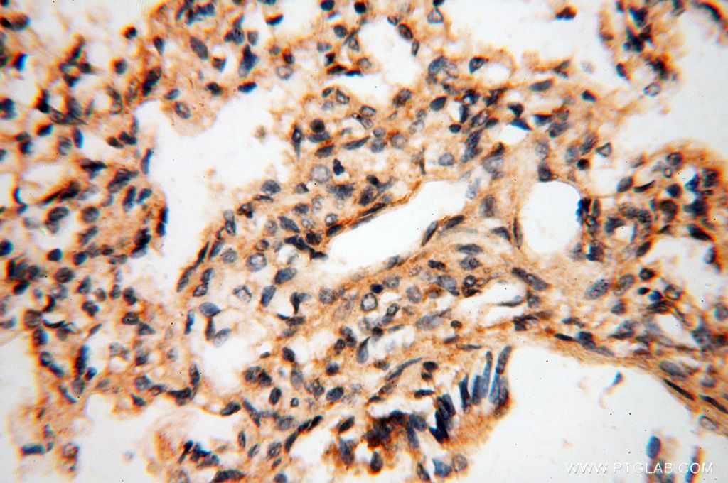 Immunohistochemistry (IHC) staining of human lung tissue using BAG1S/1M/1L Polyclonal antibody (16150-1-AP)