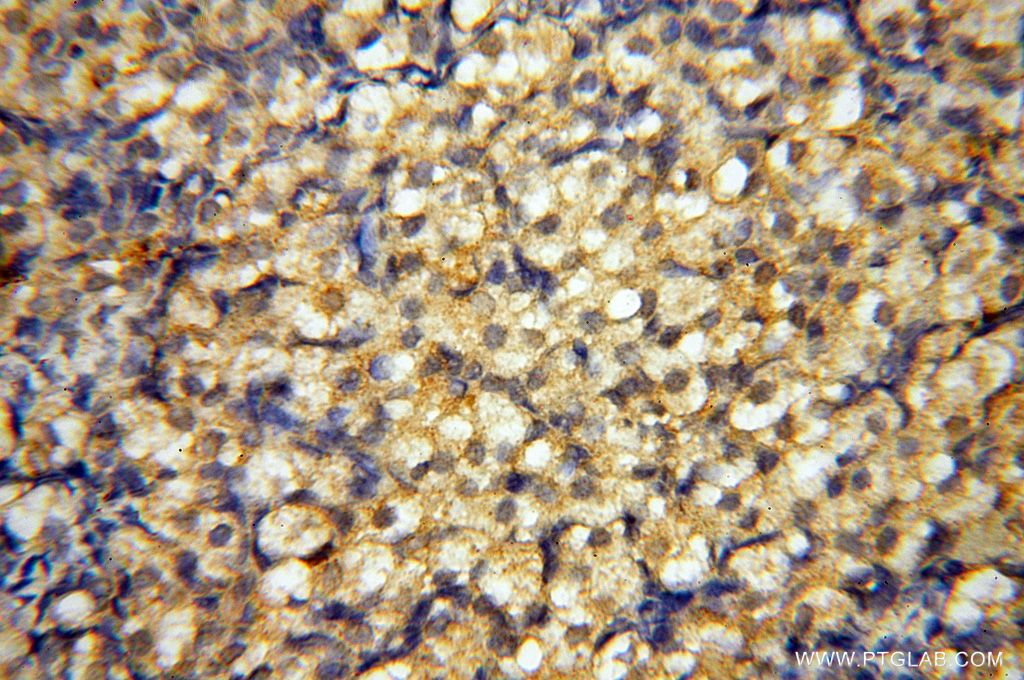 Immunohistochemistry (IHC) staining of human ovary tissue using BAG1S/1M/1L Polyclonal antibody (16150-1-AP)