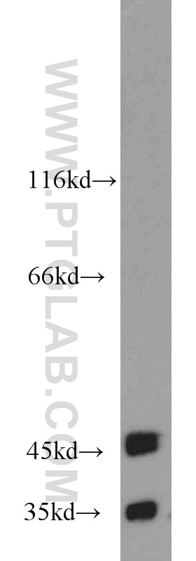 Western Blot (WB) analysis of mouse brain tissue using BAG1S/1M/1L Polyclonal antibody (16150-1-AP)