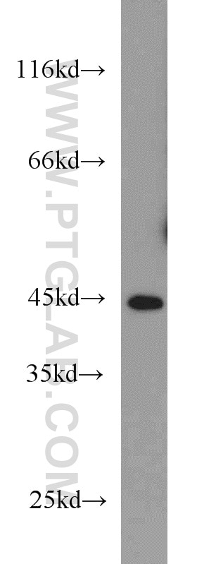 WB analysis of Jurkat using 16150-1-AP