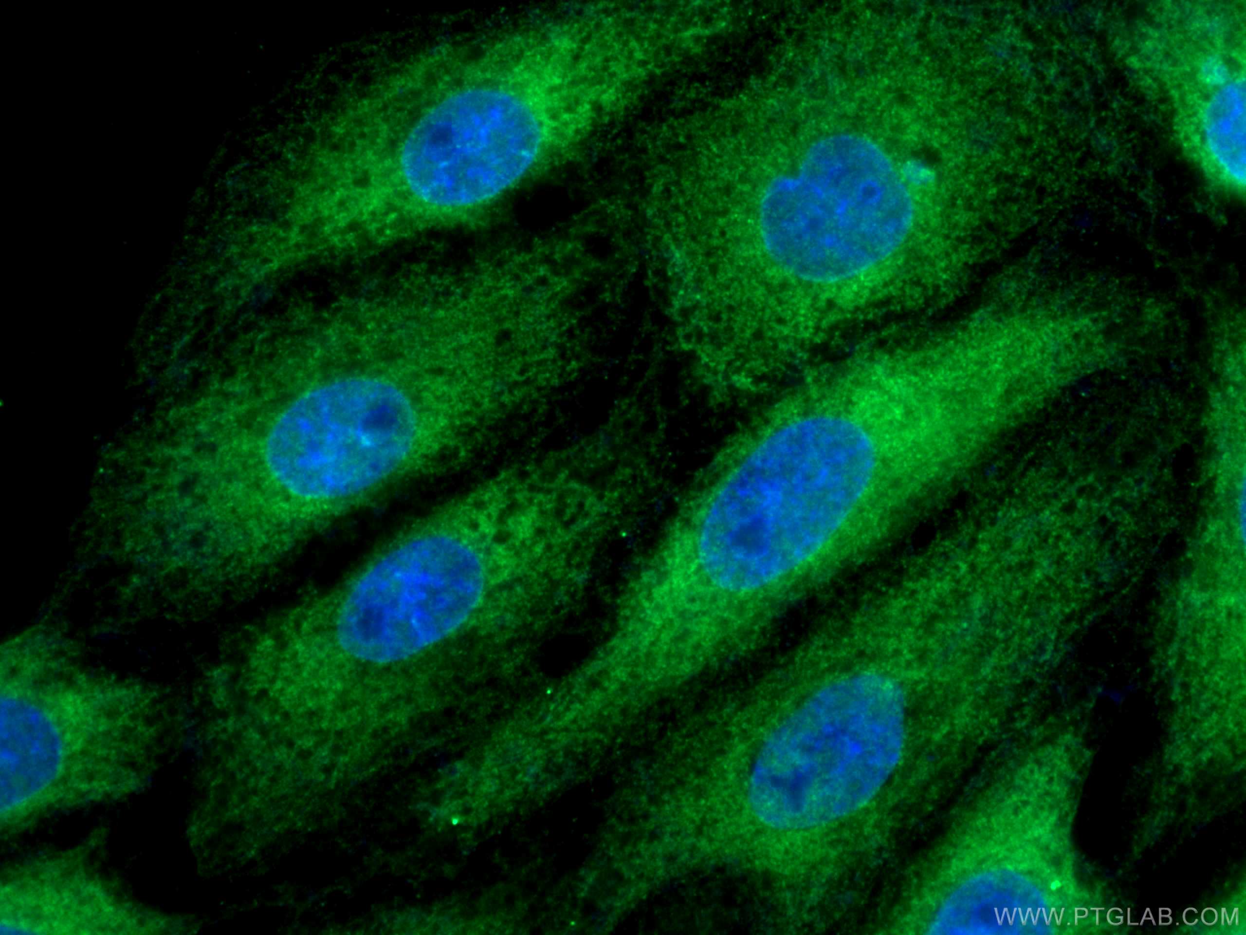 Immunofluorescence (IF) / fluorescent staining of SH-SY5Y cells using BAG3 Polyclonal antibody (10599-1-AP)