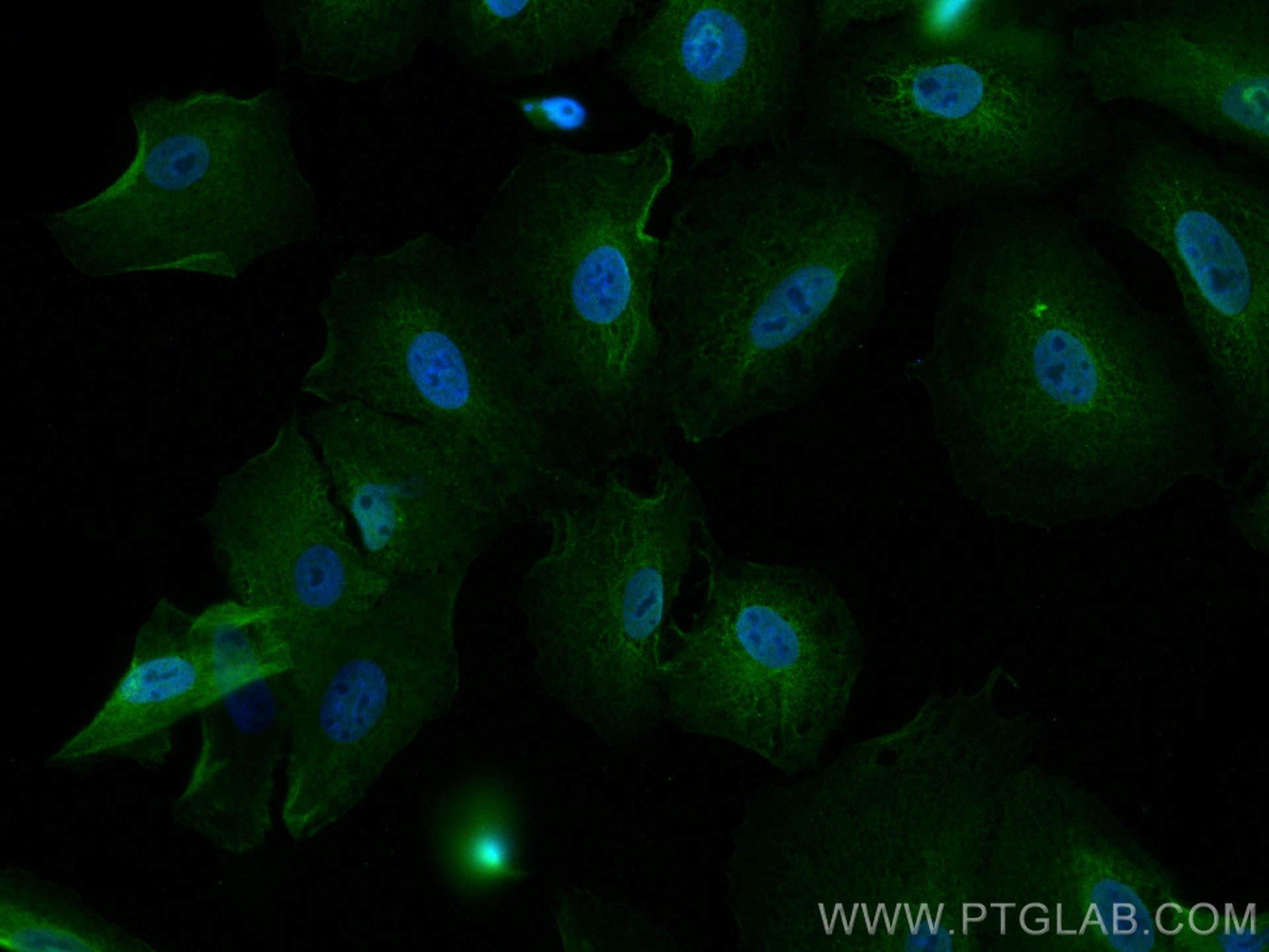 Immunofluorescence (IF) / fluorescent staining of A549 cells using BAG3 Polyclonal antibody (10599-1-AP)