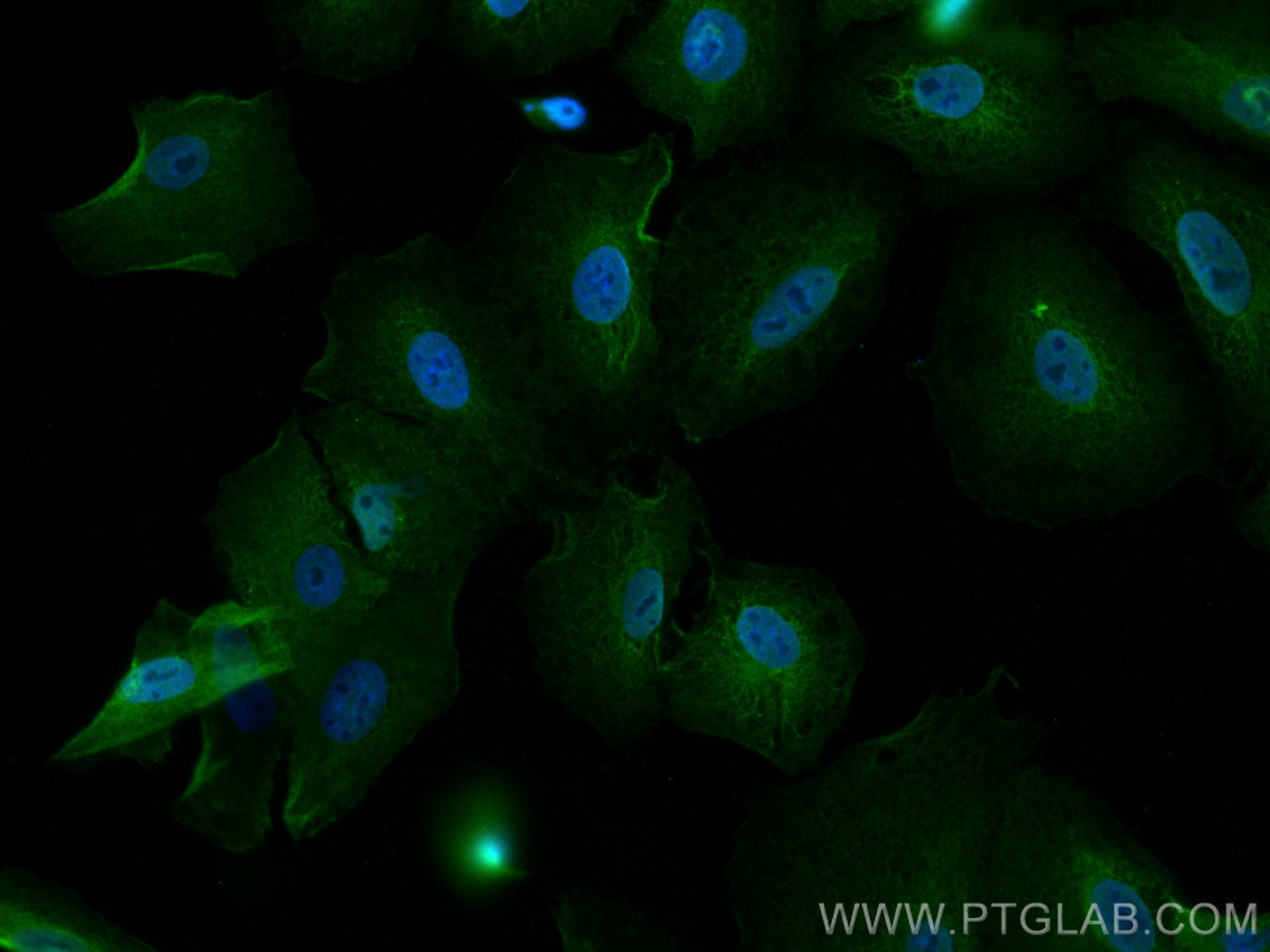 IF Staining of A549 using 10599-1-AP