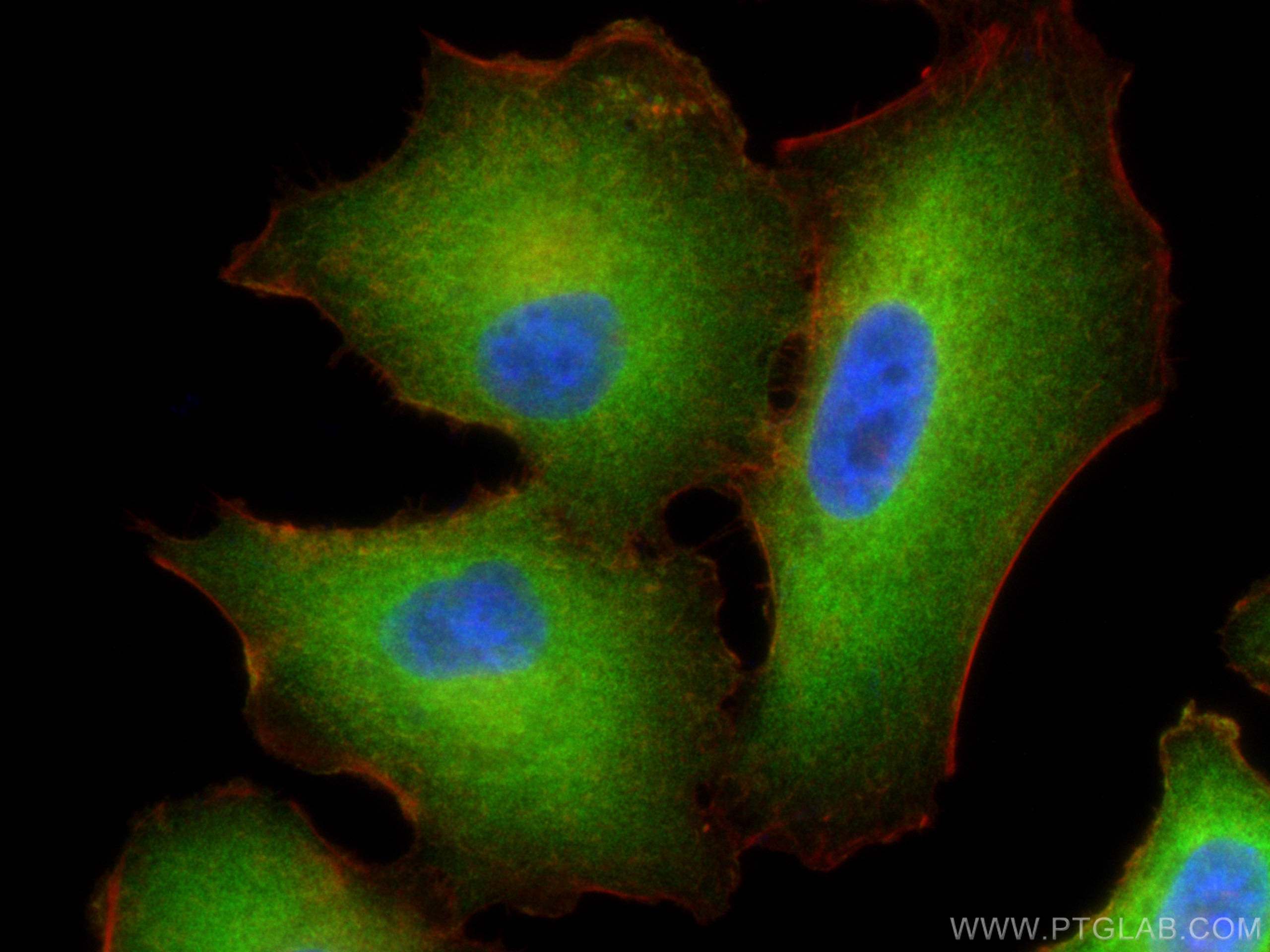 Immunofluorescence (IF) / fluorescent staining of A549 cells using BAG3 Polyclonal antibody (10599-1-AP)