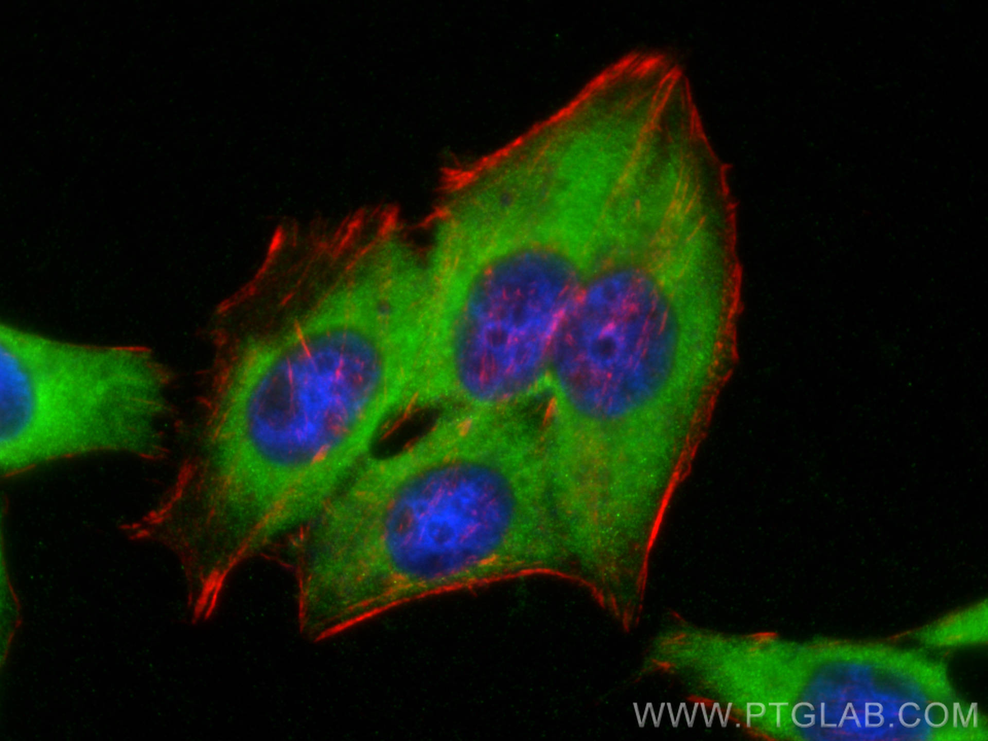 Immunofluorescence (IF) / fluorescent staining of HepG2 cells using BAG3 Polyclonal antibody (10599-1-AP)