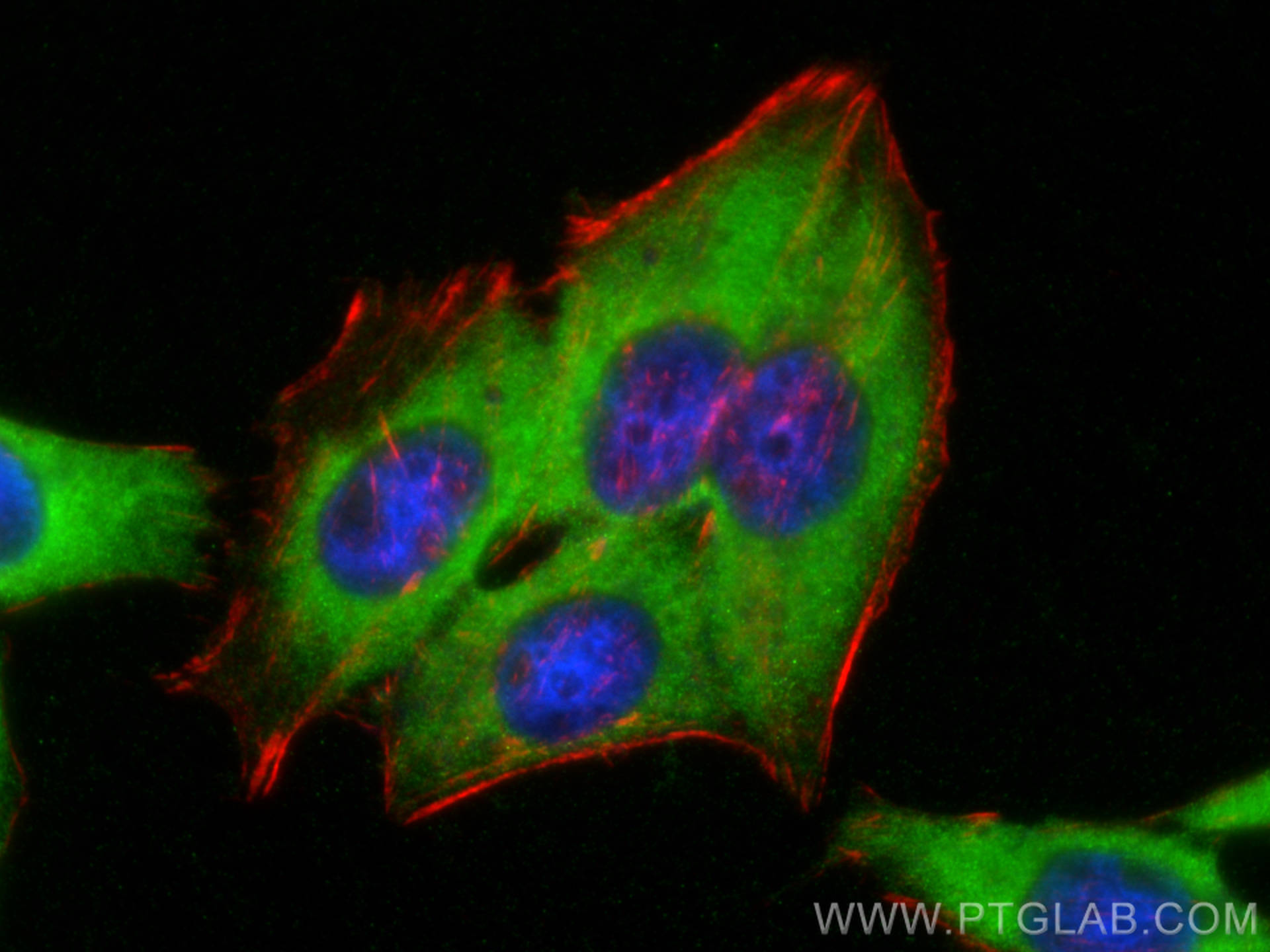 IF Staining of HepG2 using 10599-1-AP