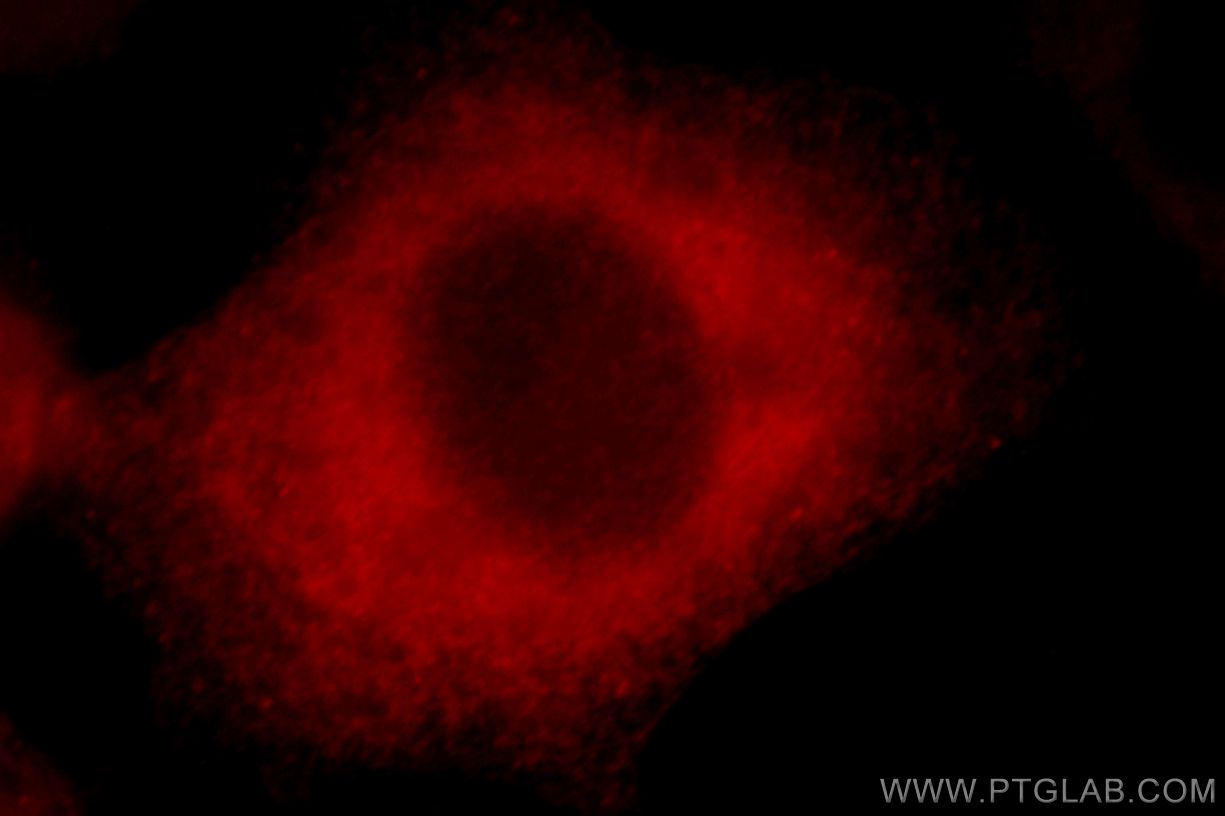 Immunofluorescence (IF) / fluorescent staining of HeLa cells using BAG3 Polyclonal antibody (10599-1-AP)