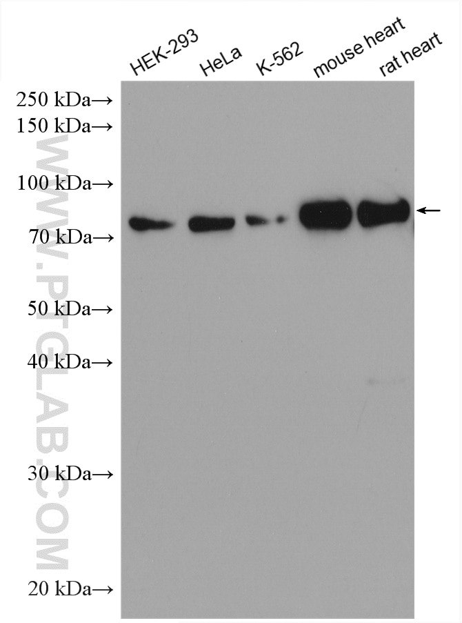 Western Blot (WB) analysis of various lysates using BAG3 Polyclonal antibody (10599-1-AP)