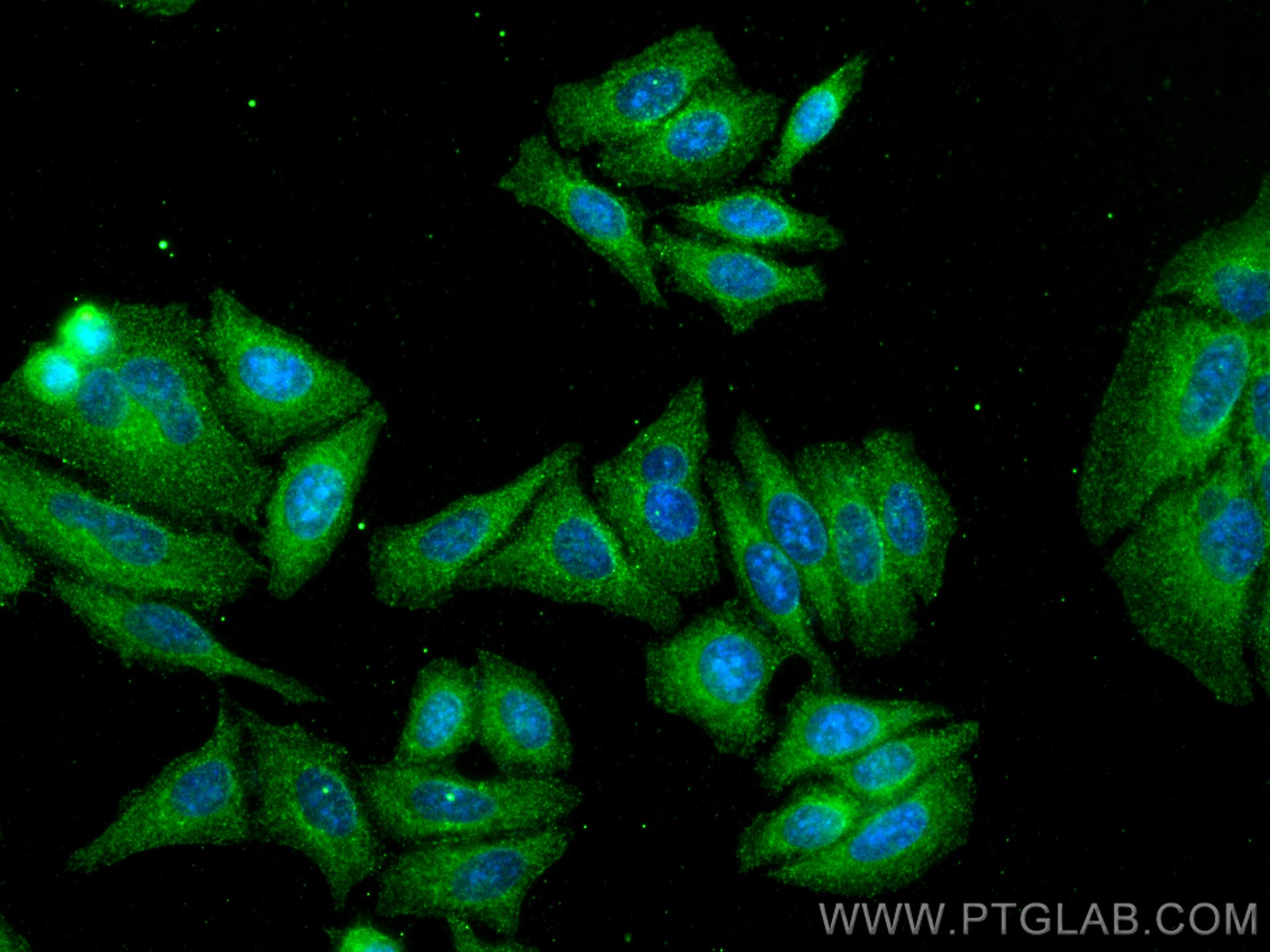 Immunofluorescence (IF) / fluorescent staining of HepG2 cells using BAG3 Monoclonal antibody (68076-1-Ig)