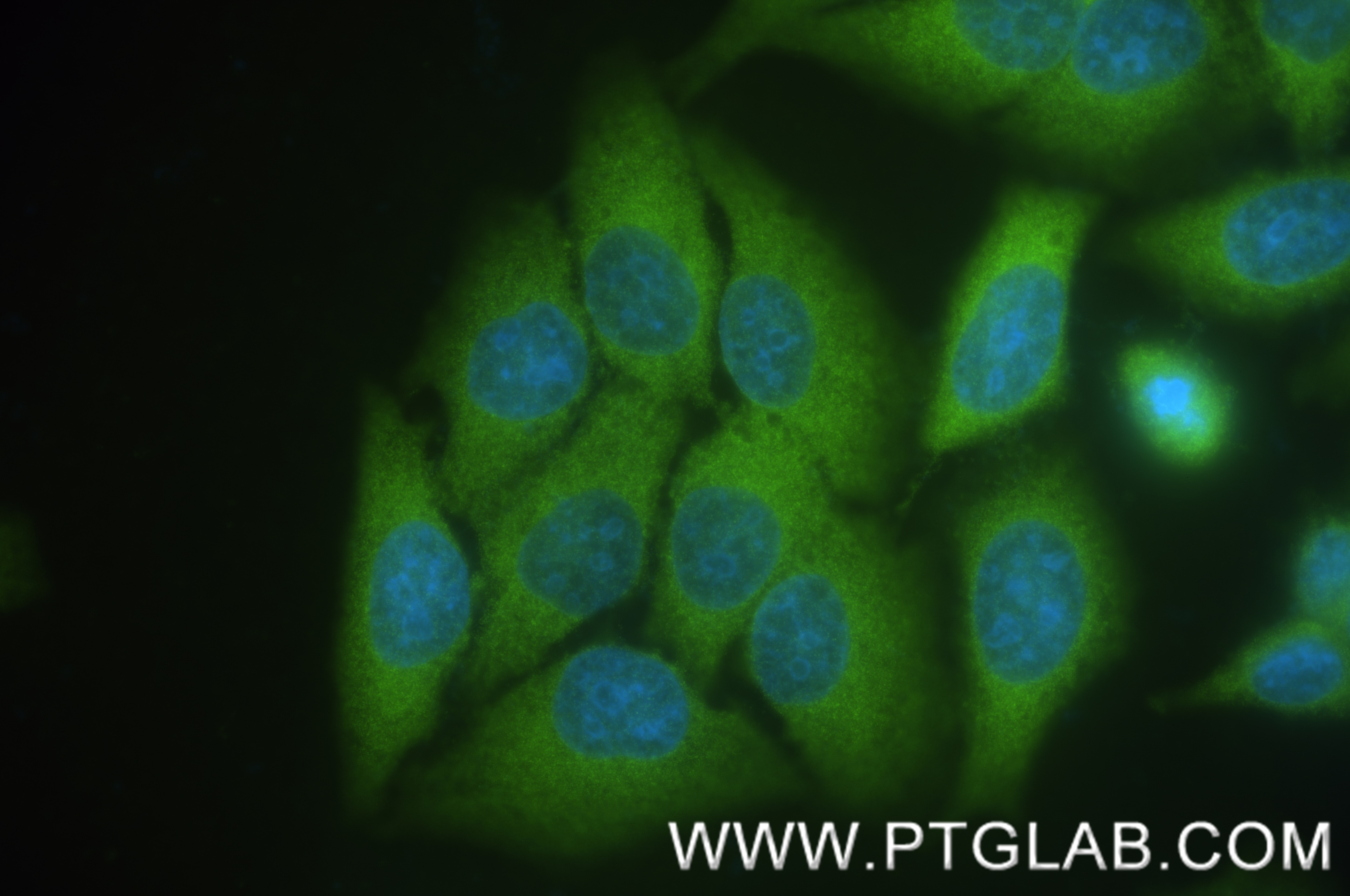 Immunofluorescence (IF) / fluorescent staining of HepG2 cells using BAG3 Recombinant antibody (83779-4-RR)