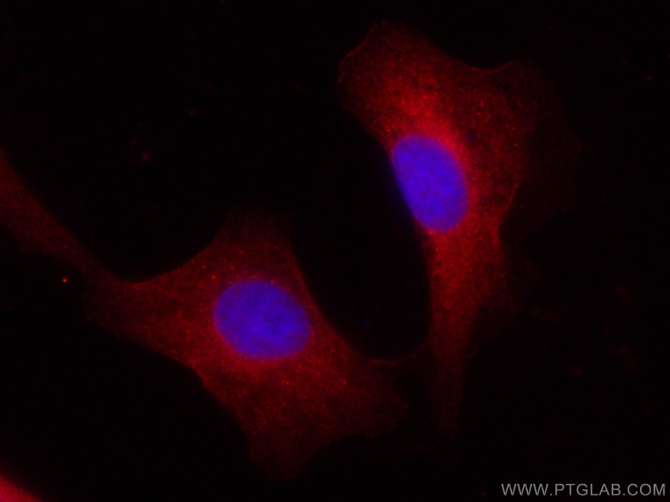 Immunofluorescence (IF) / fluorescent staining of A549 cells using CoraLite®594-conjugated BAG3 Polyclonal antibody (CL594-10599)