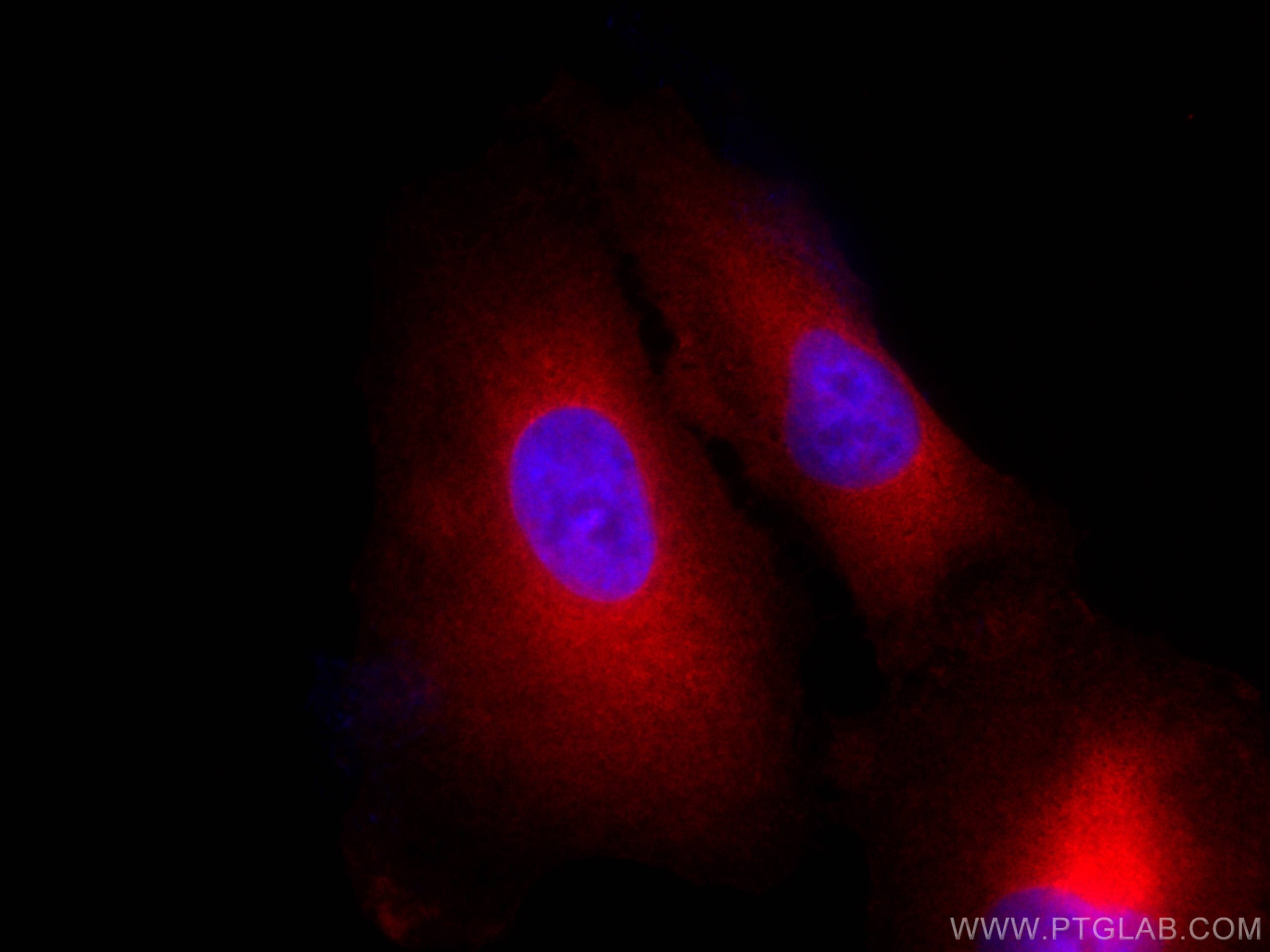 Immunofluorescence (IF) / fluorescent staining of A549 cells using CoraLite®594-conjugated BAG3 Polyclonal antibody (CL594-10599)