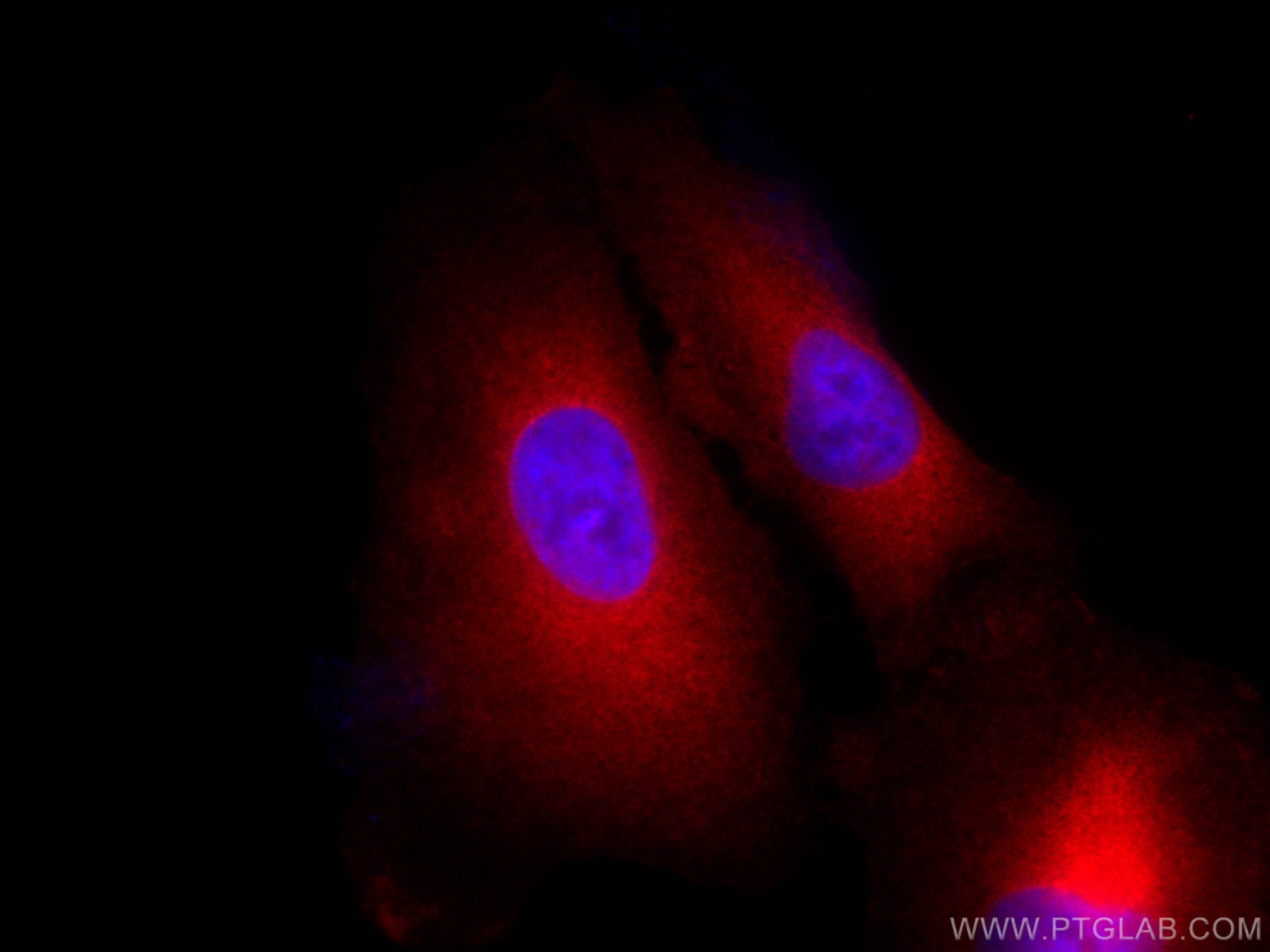 Immunofluorescence (IF) / fluorescent staining of A549 cells using CoraLite®594-conjugated BAG3 Polyclonal antibody (CL594-10599)