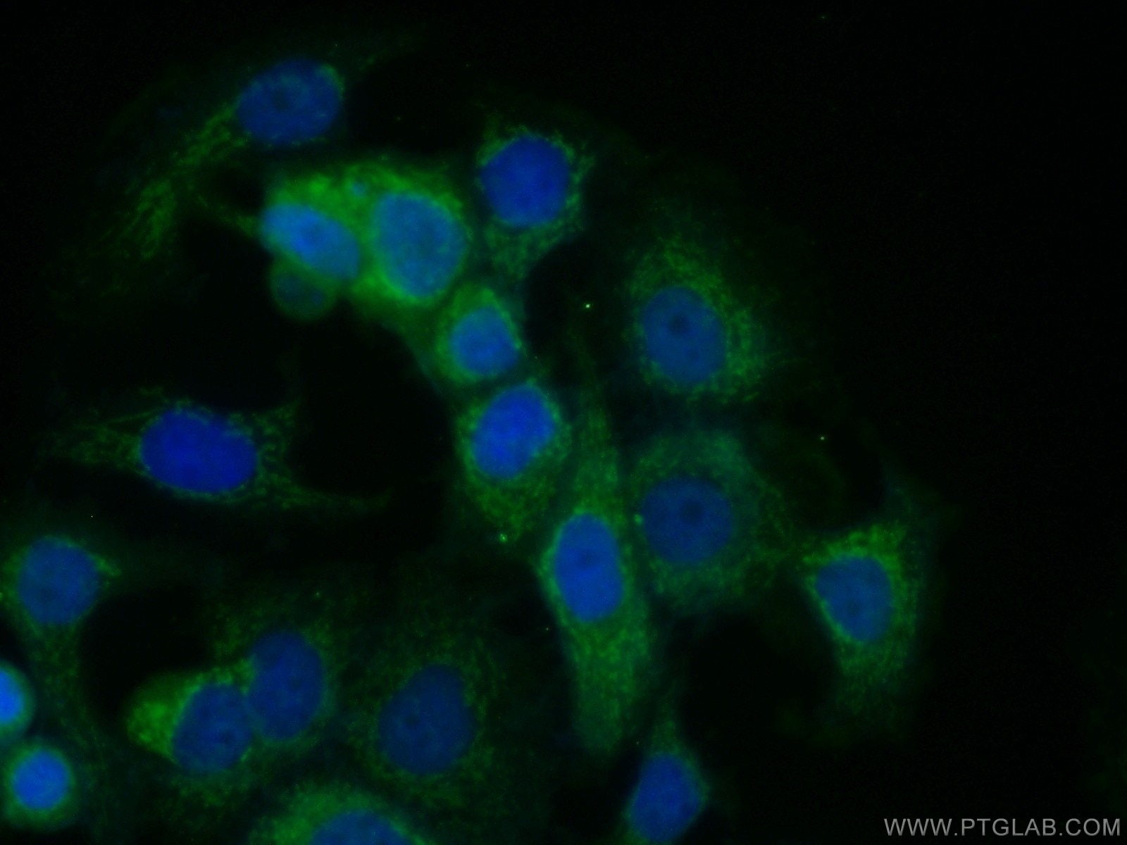 Immunofluorescence (IF) / fluorescent staining of MCF-7 cells using SODD/BAG4 Polyclonal antibody (13913-1-AP)