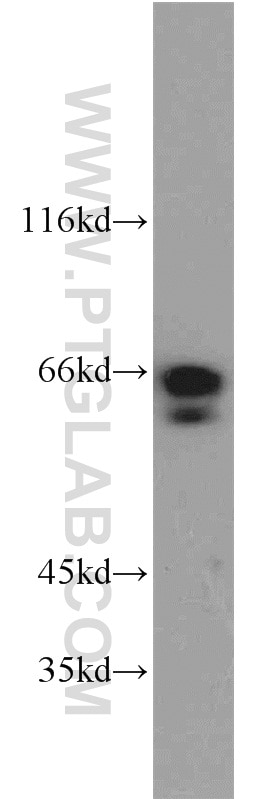 Western Blot (WB) analysis of MCF-7 cells using SODD/BAG4 Polyclonal antibody (13913-1-AP)