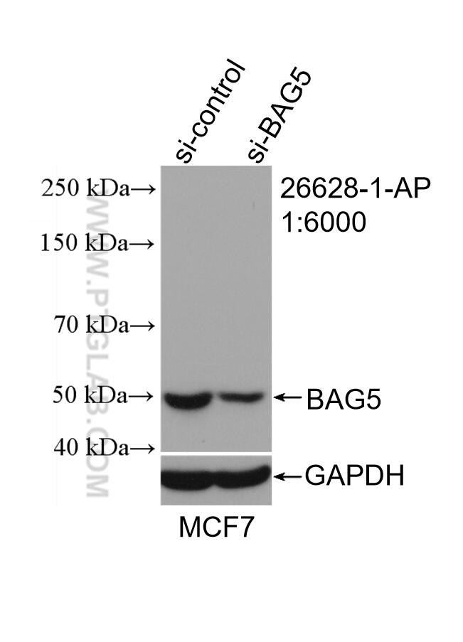 Western Blot (WB) analysis of MCF-7 cells using BAG5 Polyclonal antibody (26628-1-AP)