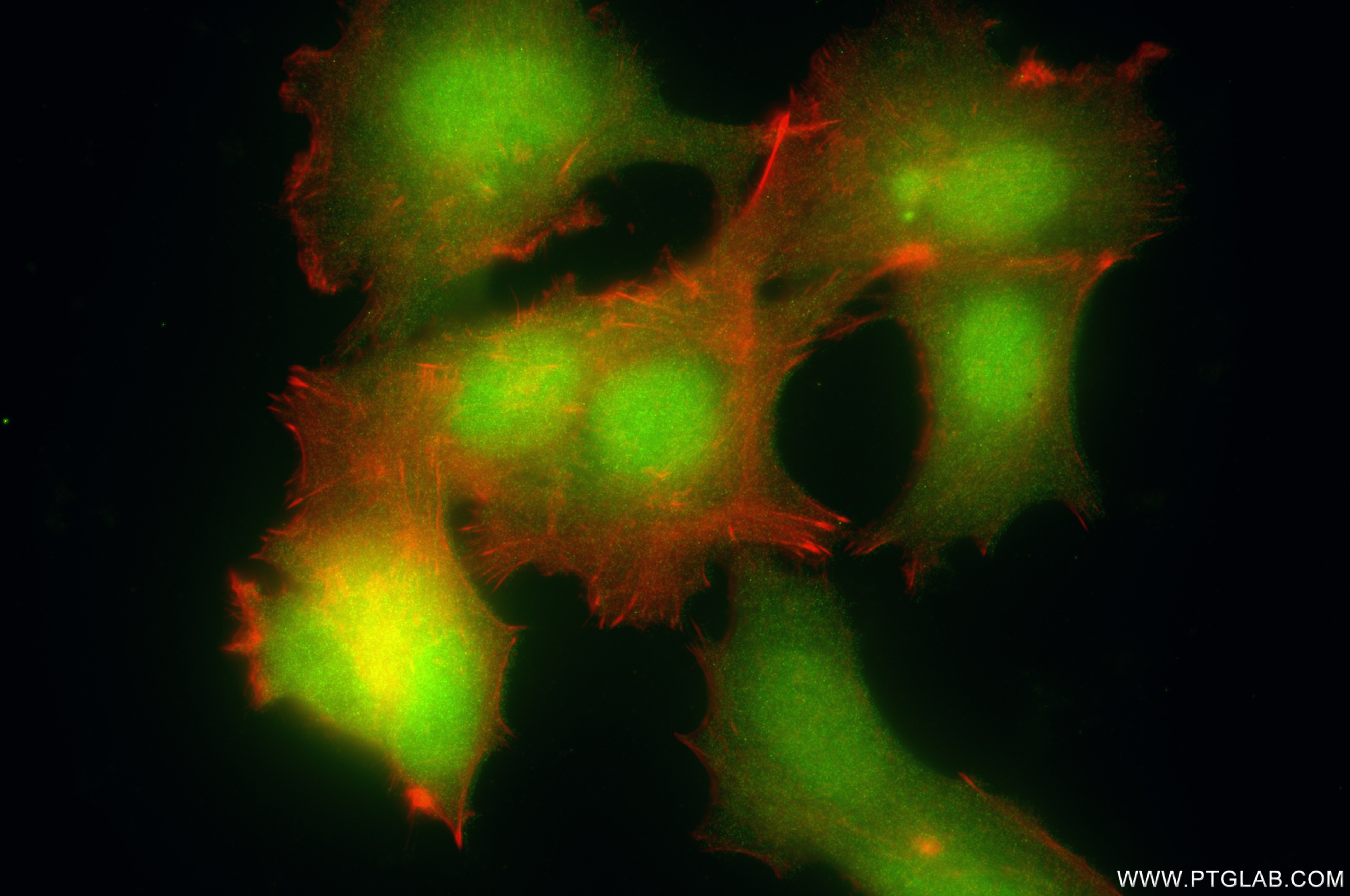 Immunofluorescence (IF) / fluorescent staining of MCF-7 cells using BAG5 Recombinant antibody (86248-1-RR)