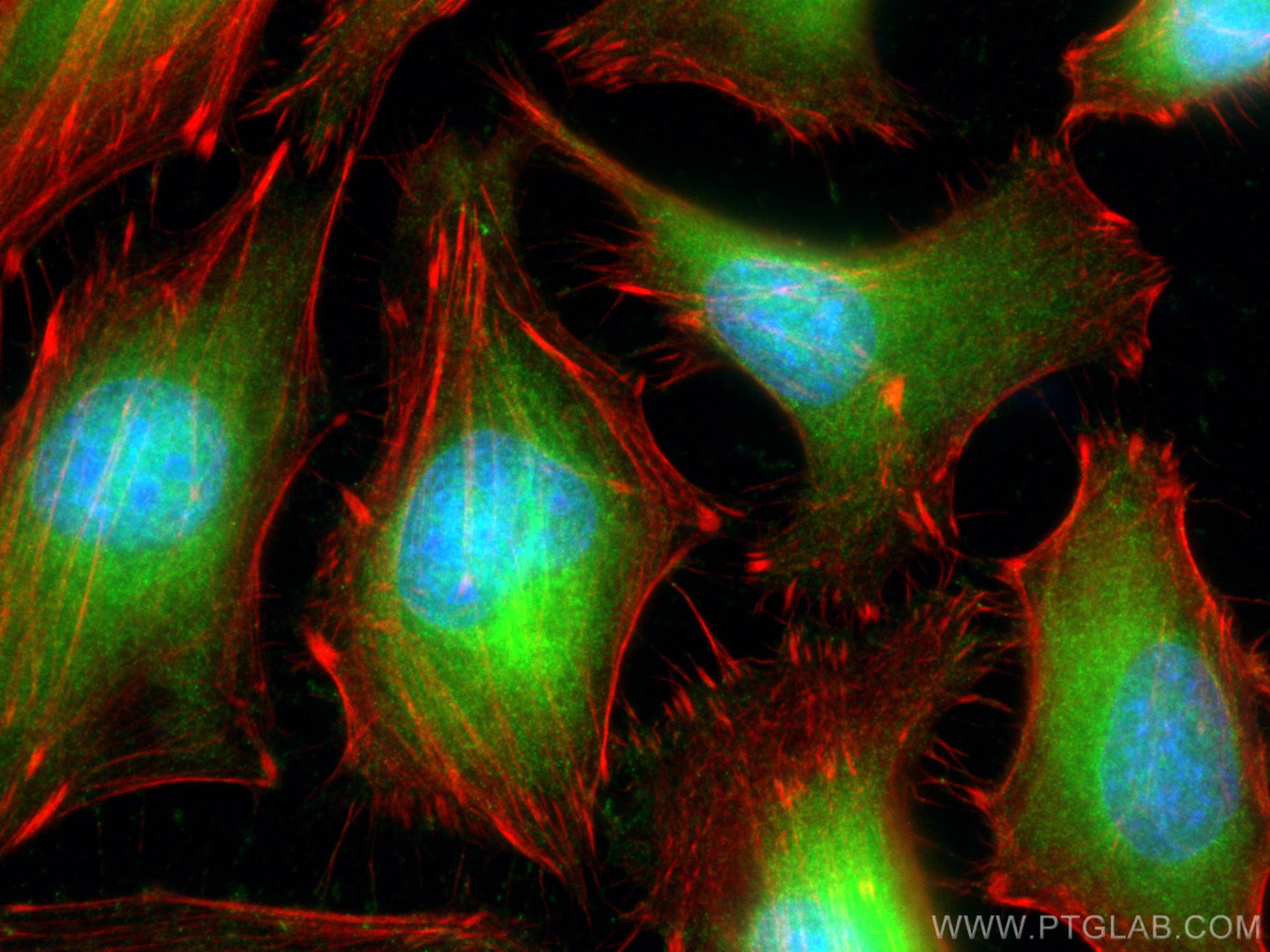 Immunofluorescence (IF) / fluorescent staining of HeLa cells using BAG6 Polyclonal antibody (26417-1-AP)