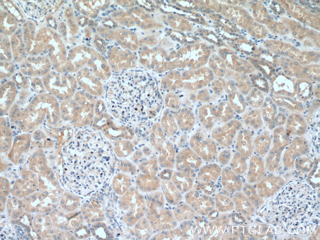 Immunohistochemistry (IHC) staining of human kidney tissue using BAG6 Polyclonal antibody (26417-1-AP)