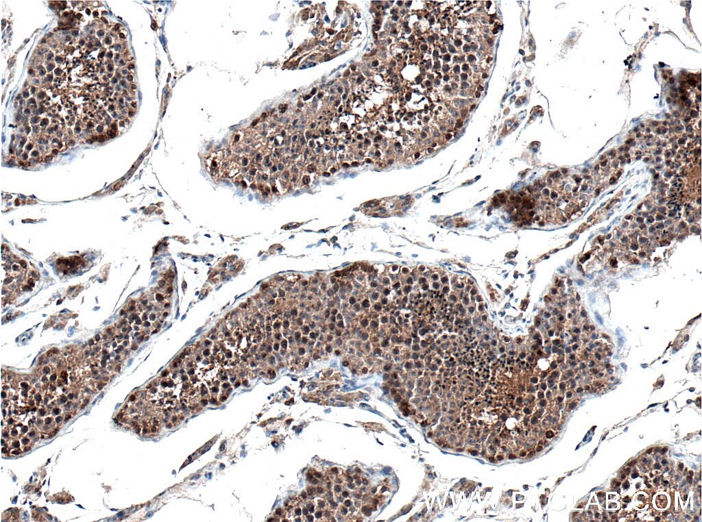 Immunohistochemistry (IHC) staining of human testis tissue using BAG6 Monoclonal antibody (66661-1-Ig)