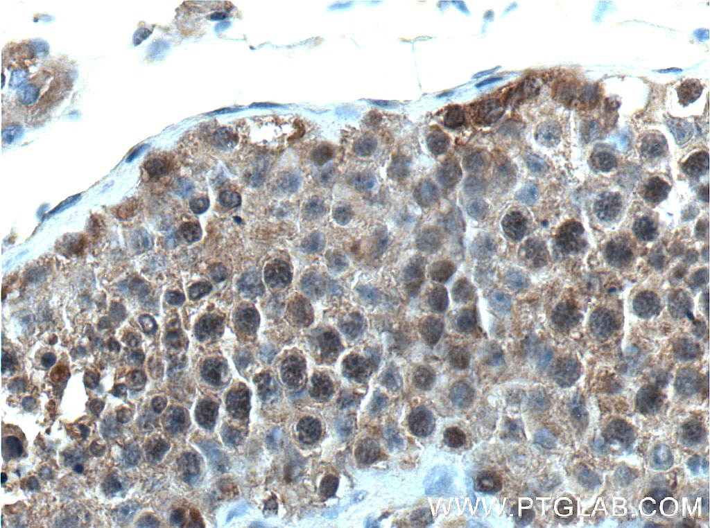 Immunohistochemistry (IHC) staining of human testis tissue using BAG6 Monoclonal antibody (66661-1-Ig)