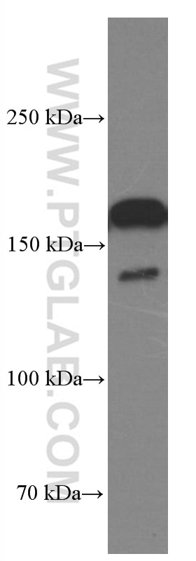 WB analysis of HSC-T6 using 66661-1-Ig