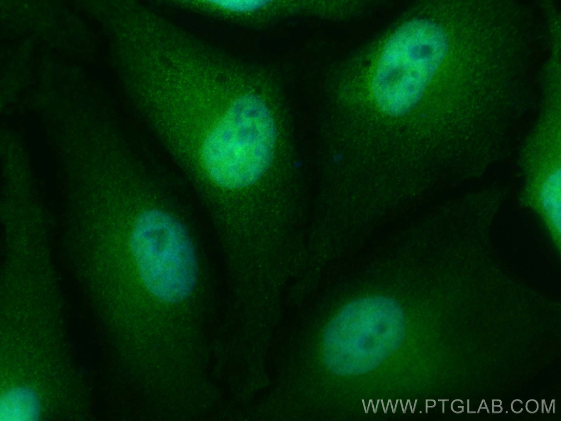 IF Staining of HeLa using CL488-26417