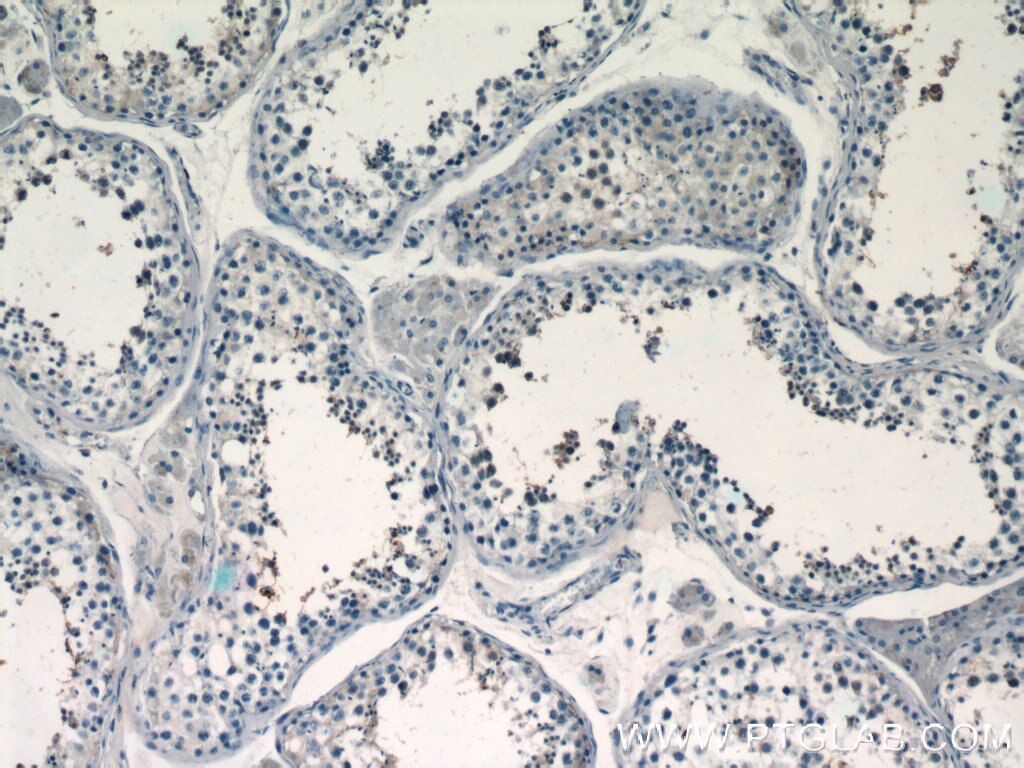 Immunohistochemistry (IHC) staining of human testis tissue using BAGE4 Polyclonal antibody (20071-1-AP)