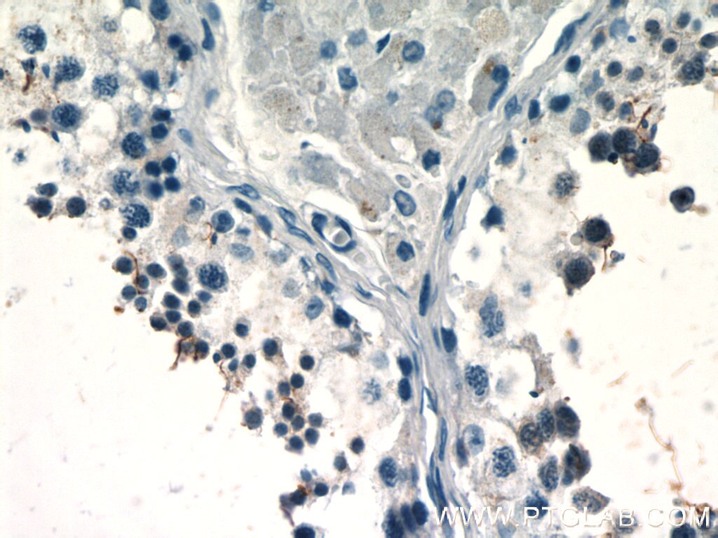 Immunohistochemistry (IHC) staining of human testis tissue using BAGE4 Polyclonal antibody (20071-1-AP)