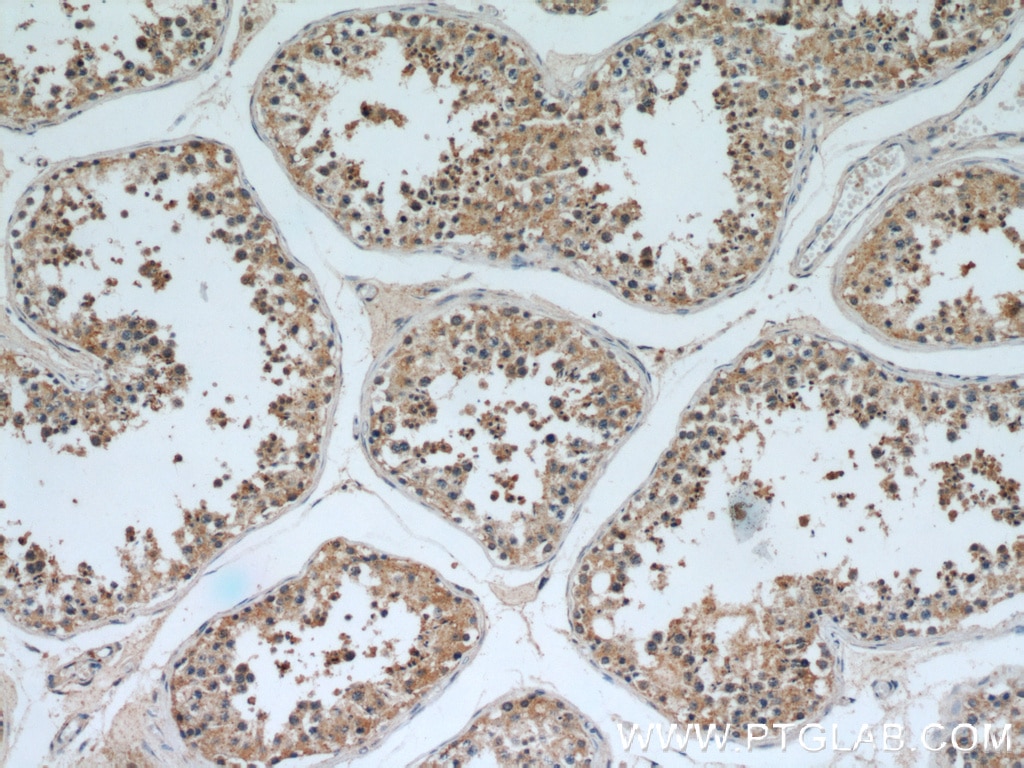 Immunohistochemistry (IHC) staining of human testis tissue using BAGE4 Polyclonal antibody (20071-1-AP)