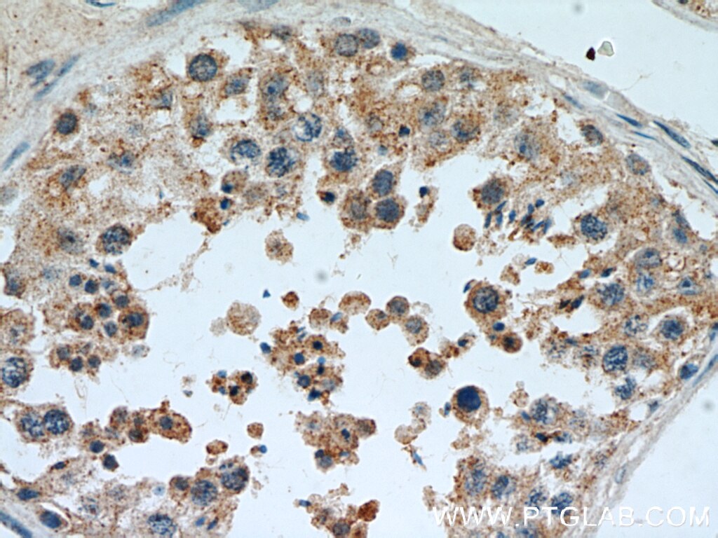 Immunohistochemistry (IHC) staining of human testis tissue using BAGE4 Polyclonal antibody (20071-1-AP)