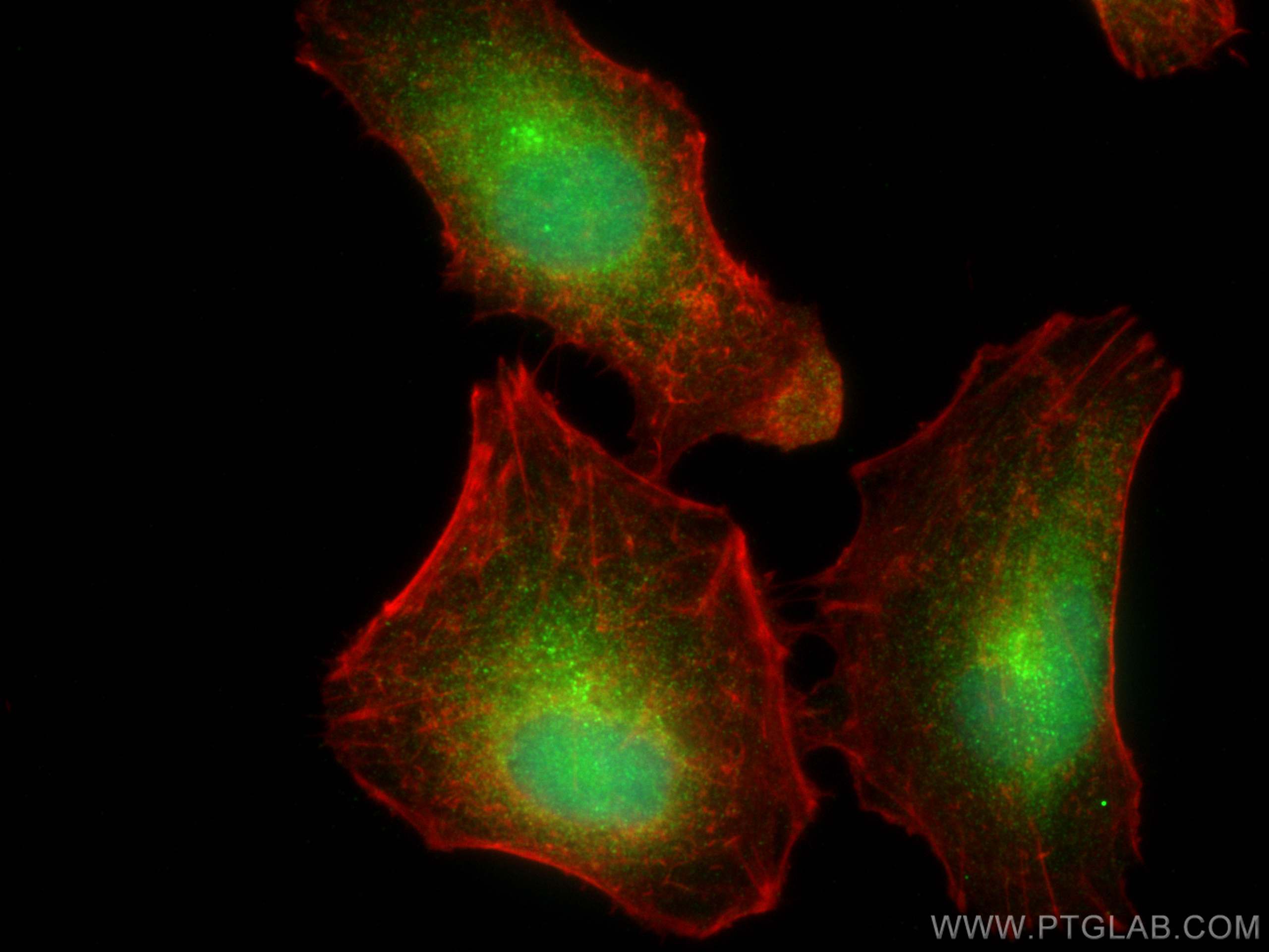 Immunofluorescence (IF) / fluorescent staining of A549 cells using BAHCC1 Polyclonal antibody (30046-1-AP)