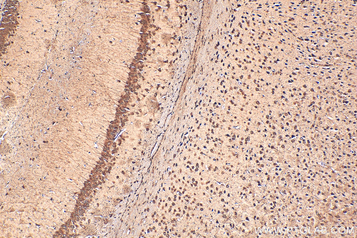 Immunohistochemistry (IHC) staining of mouse brain tissue using BAHCC1 Polyclonal antibody (30046-1-AP)