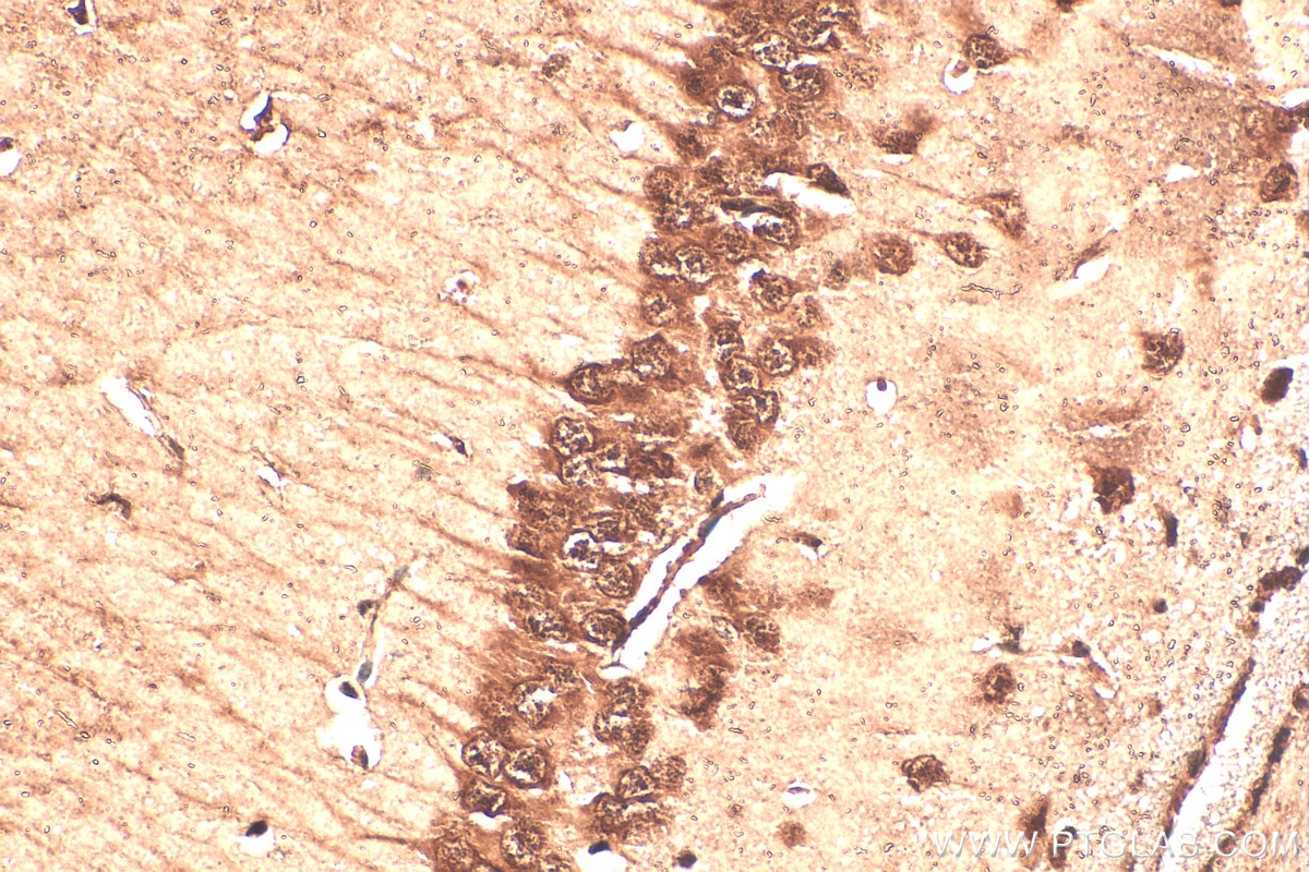 Immunohistochemistry (IHC) staining of mouse brain tissue using BAHCC1 Polyclonal antibody (30046-1-AP)