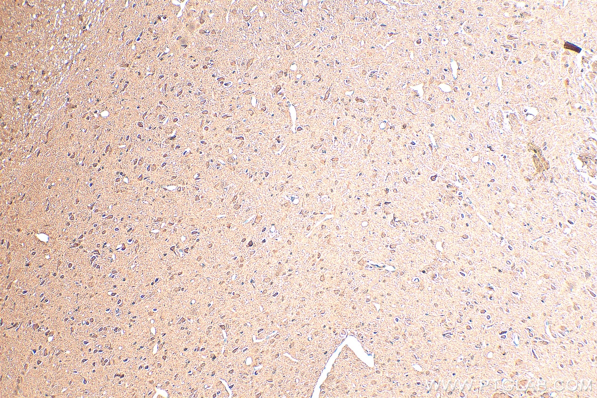 Immunohistochemistry (IHC) staining of rat brain tissue using BAHCC1 Polyclonal antibody (30046-1-AP)