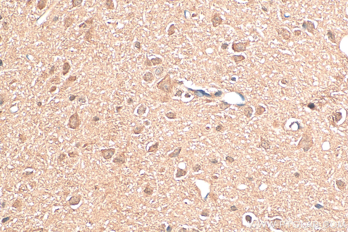 Immunohistochemistry (IHC) staining of rat brain tissue using BAHCC1 Polyclonal antibody (30046-1-AP)