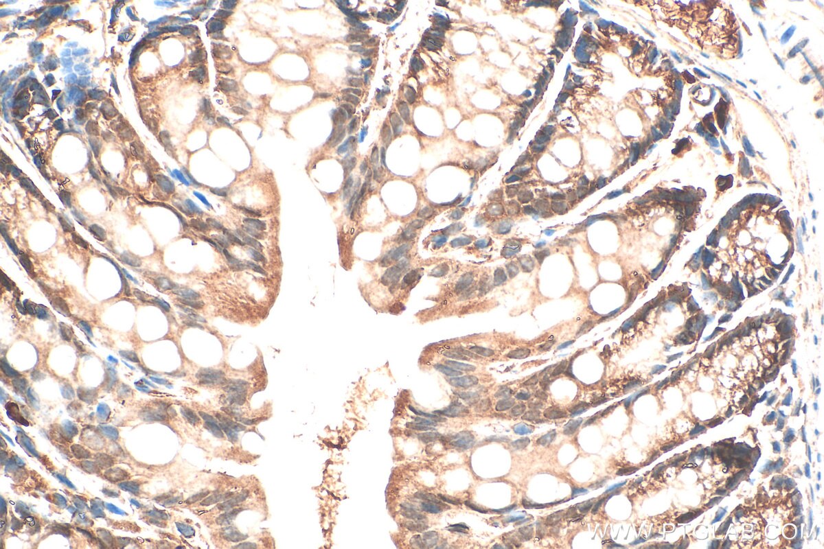 Immunohistochemistry (IHC) staining of mouse colon tissue using BAHCC1 Polyclonal antibody (30046-1-AP)