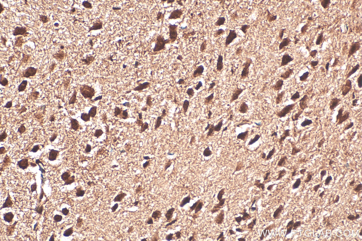 Immunohistochemistry (IHC) staining of mouse brain tissue using BAHCC1 Polyclonal antibody (30046-1-AP)
