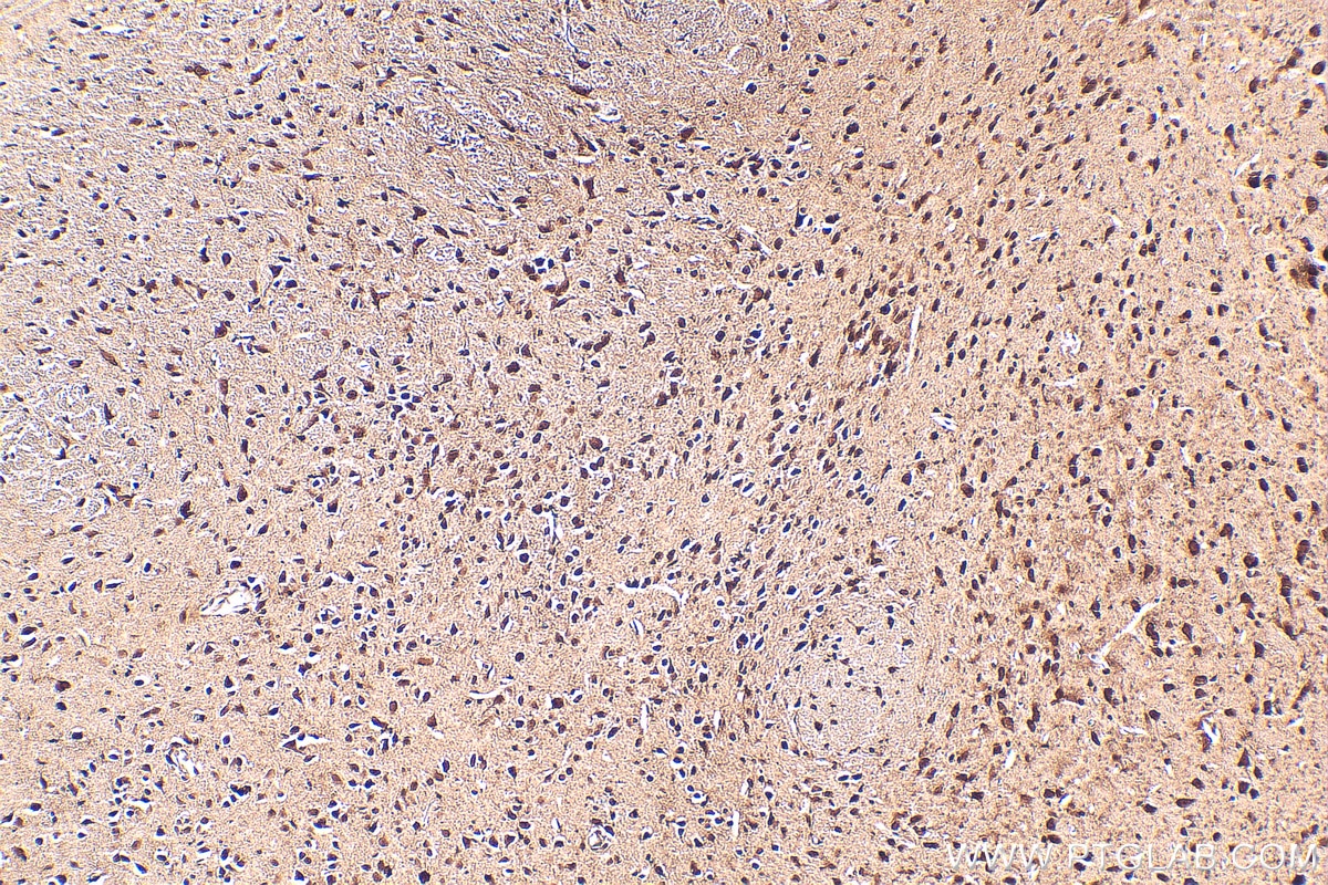 Immunohistochemistry (IHC) staining of mouse brain tissue using BAHCC1 Polyclonal antibody (30046-1-AP)