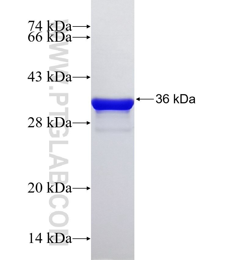 BAHCC1 fusion protein Ag32599 SDS-PAGE