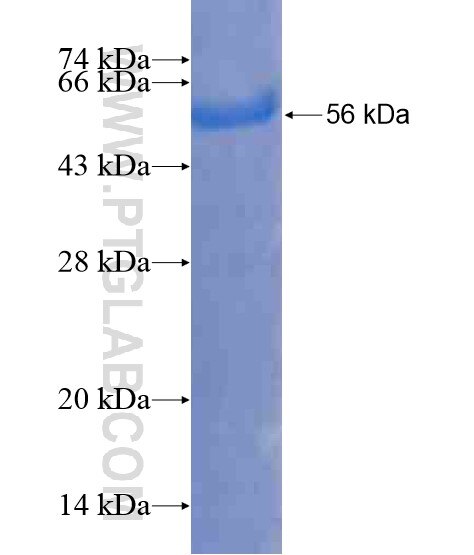 BAHD1 fusion protein Ag21164 SDS-PAGE