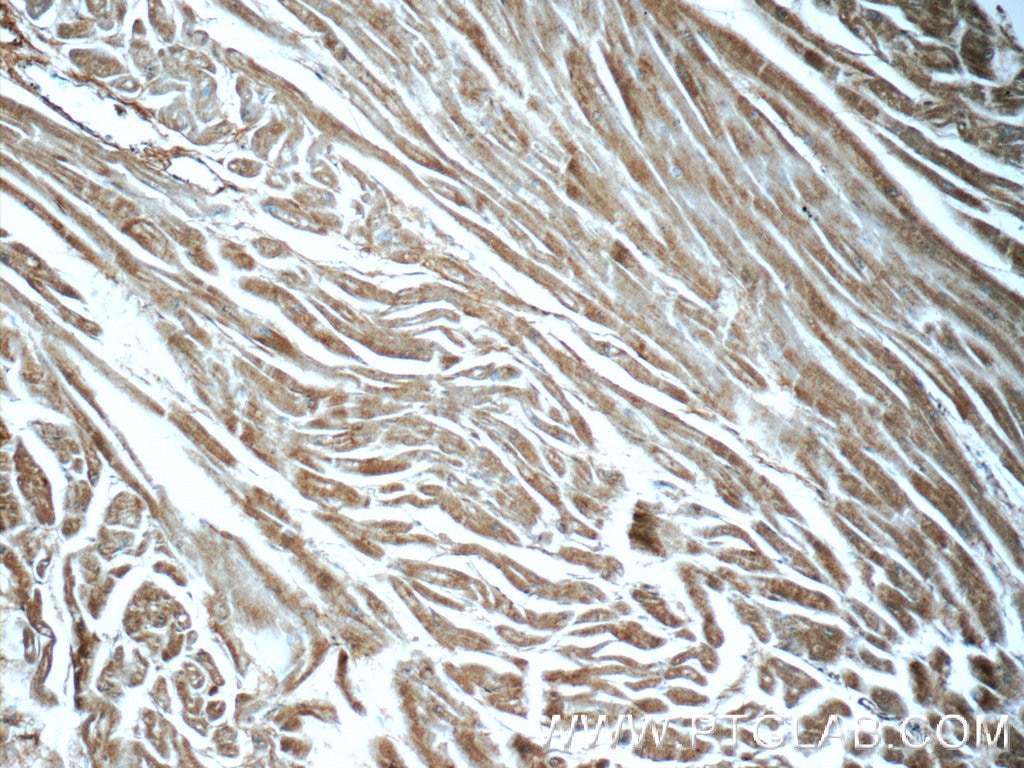 Immunohistochemistry (IHC) staining of human heart tissue using BAI2-Specific Polyclonal antibody (19680-1-AP)
