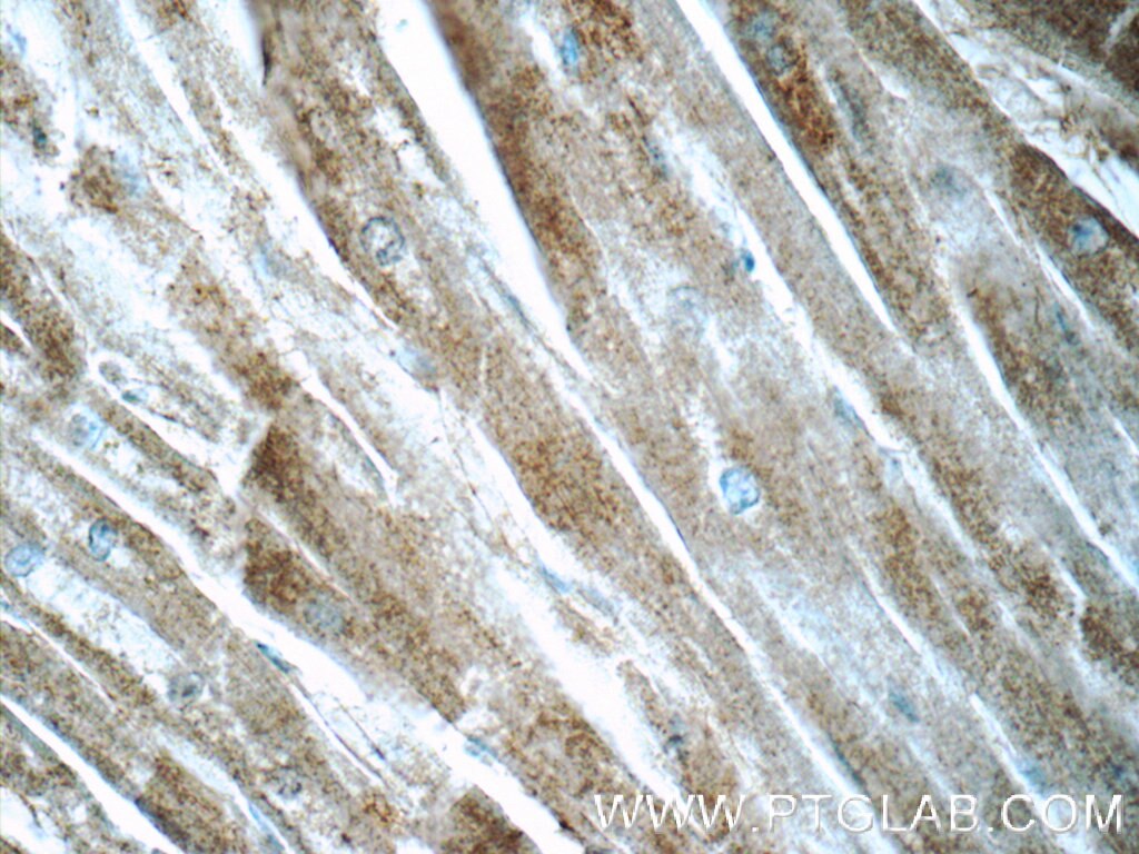 Immunohistochemistry (IHC) staining of human heart tissue using BAI2-Specific Polyclonal antibody (19680-1-AP)