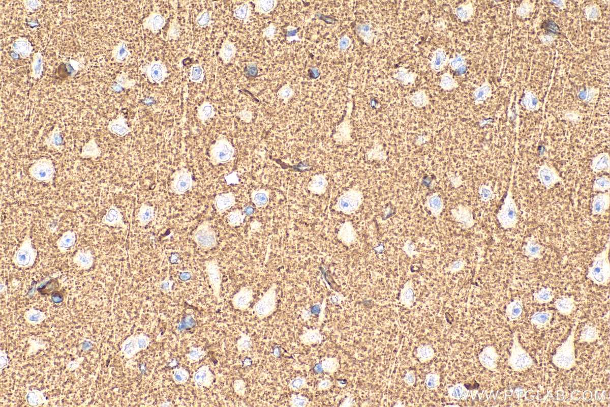 Immunohistochemistry (IHC) staining of mouse brain tissue using BAI3-Specific Polyclonal antibody (19789-1-AP)