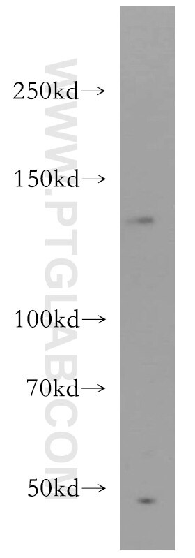 Western Blot (WB) analysis of Jurkat cells using BAI3-Specific Polyclonal antibody (19789-1-AP)